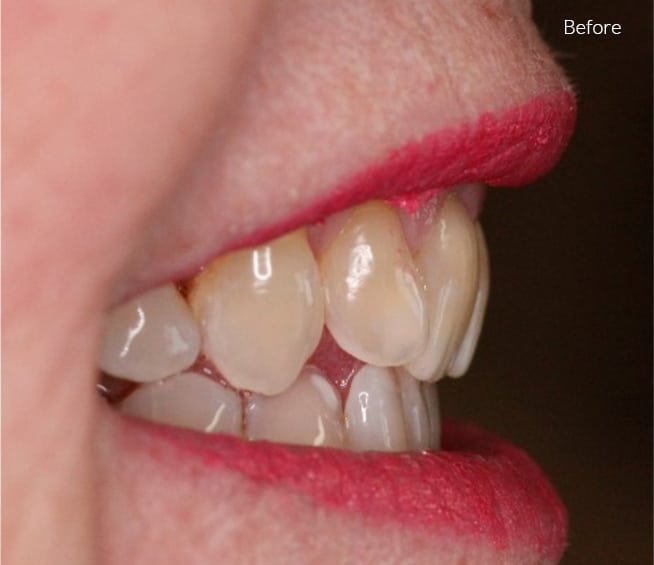 Before Cosmetic Dentistry