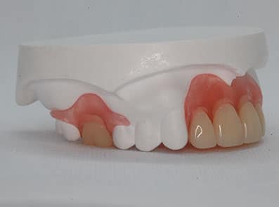 Best Denture Dentist Carmel Indiana
