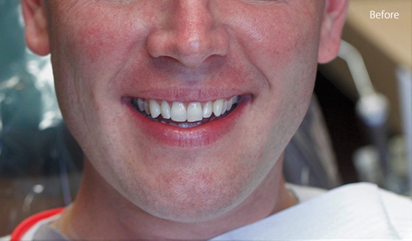 Before Cosmetic Dentistry