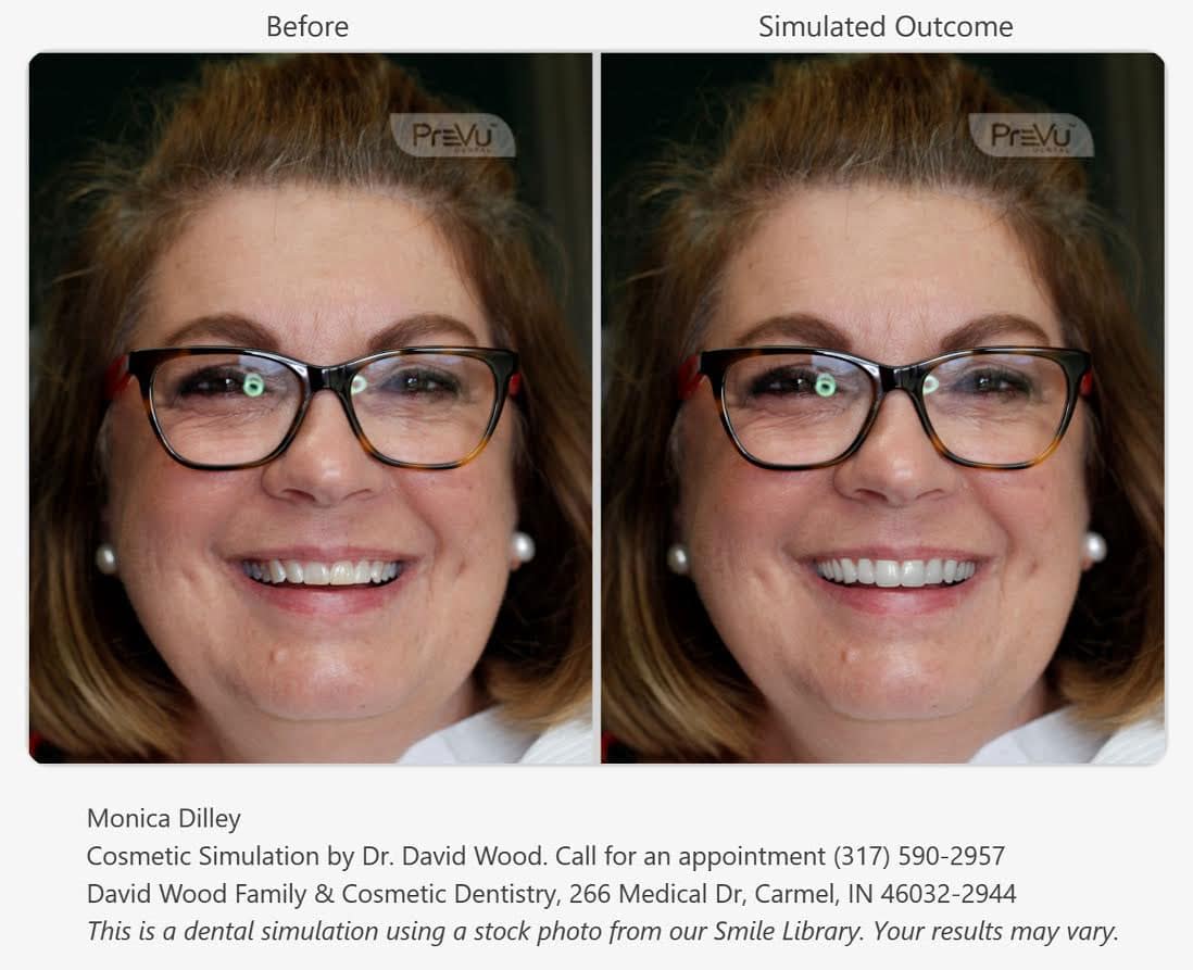 Cosmetic Dental Procedures Carmel Indiana