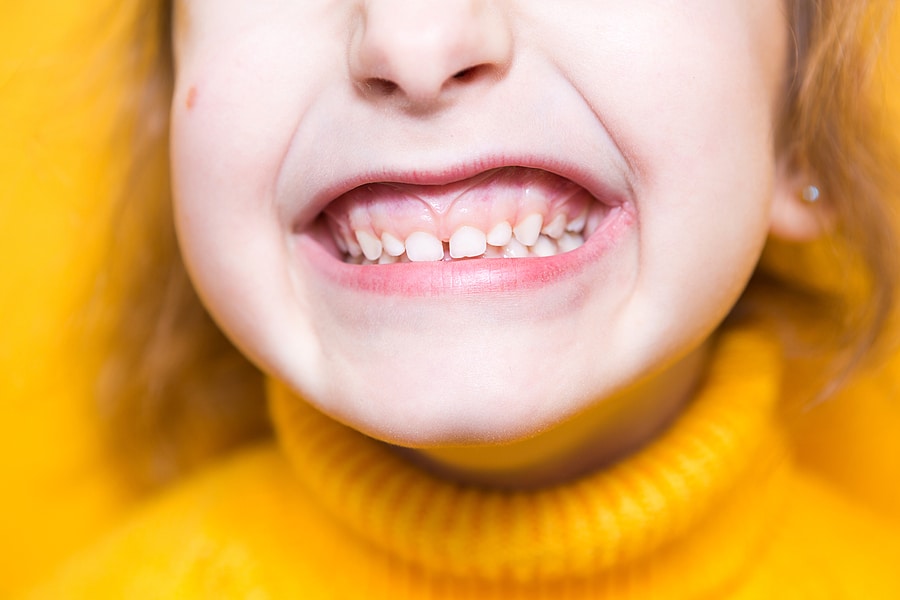 The Most Common Dental Issues for Kids
